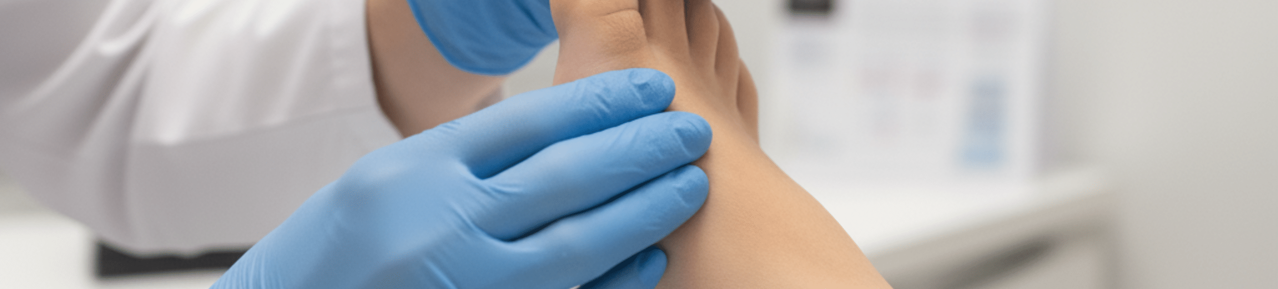 Examen clinique du pied par un médecin évaluant la déviation du gros orteil.