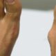 Hallux valgus : symptômes, traitements et chirurgie du “oignon du pied” à Paris