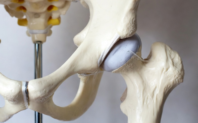 Articulation coxo-fémorale – hanche droite ou gauche