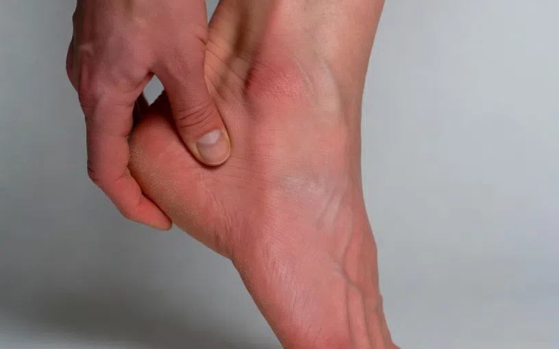 Douleur au talon avec inflammation lors de l’appui du pied