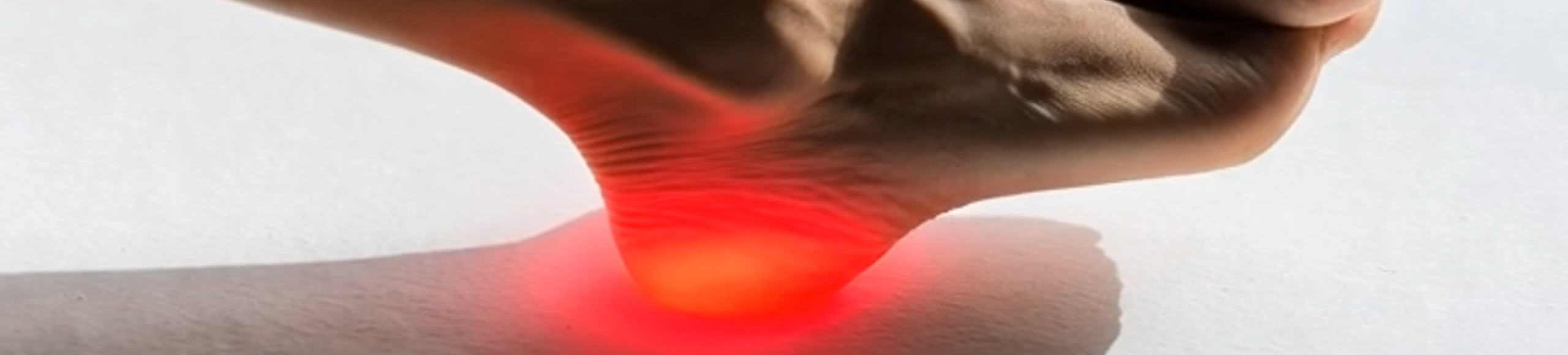 Douleur sous le pied localisée au talon, évocatrice d’une fasciite plantaire