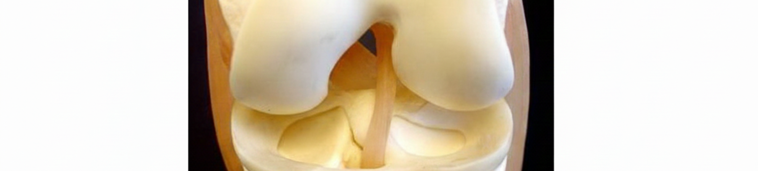 Anatomie du ligament croisé antérieur du genou reliant le fémur au tibia