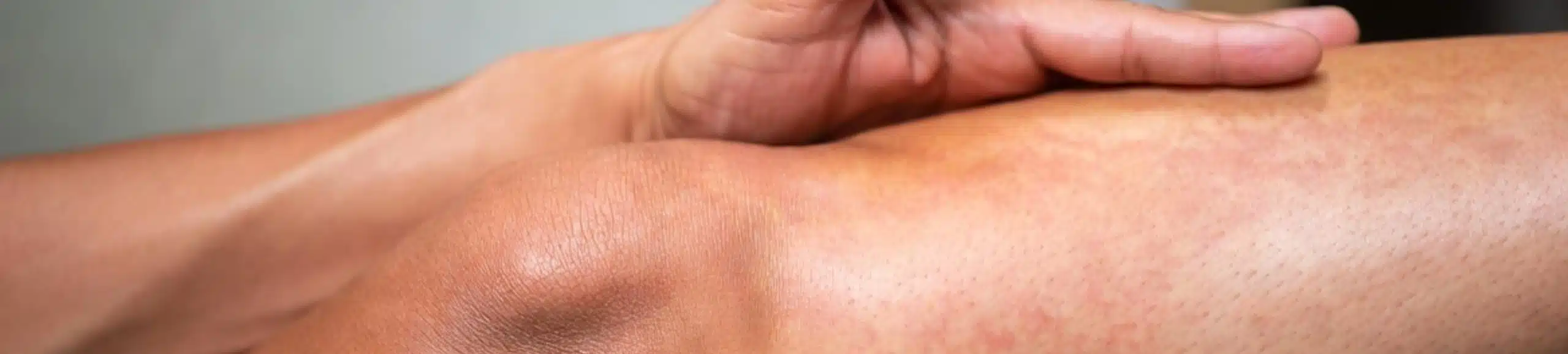 Personne tenant son genou avec une douleur irradiant dans la jambe, montrant une inflammation de la face antérieure du tibia.
