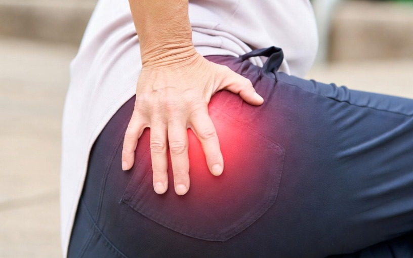 Douleur de la hanche droite ou gauche localisée à la fesse
